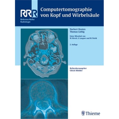 预订不退不换德语 Computertomographie von Kopf und Wirbelsäule[9783131171122]