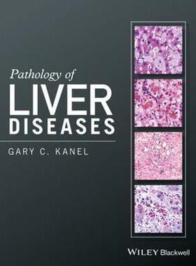 按需印刷不退不换Pathology of Liver Diseases[9781118895030]