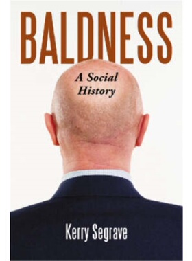 按需印刷Baldness