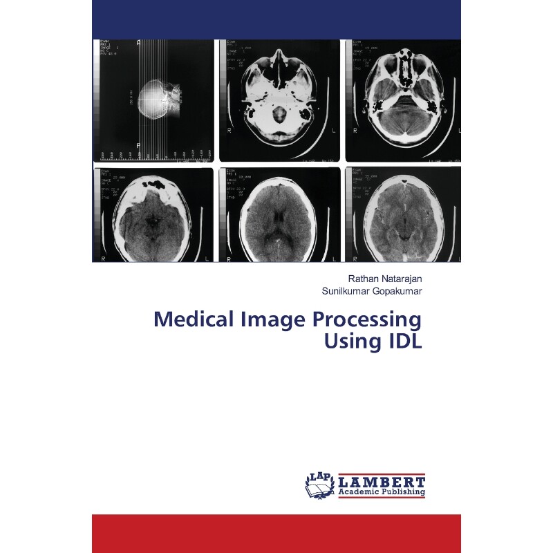 按需印刷不退不换Medical Image Processing Using IDL[9786202565998]