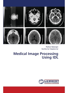 按需印刷不退不换Medical Image Processing Using IDL[9786202565998]