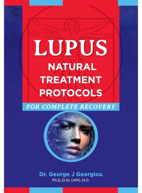 按需印刷不退不换Lupus[9789925569120]