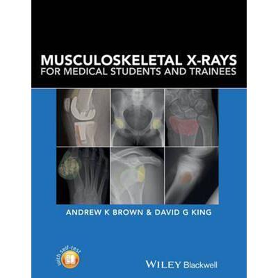 按需印刷Musculoskeletal X-rays PB[9781118458730]
