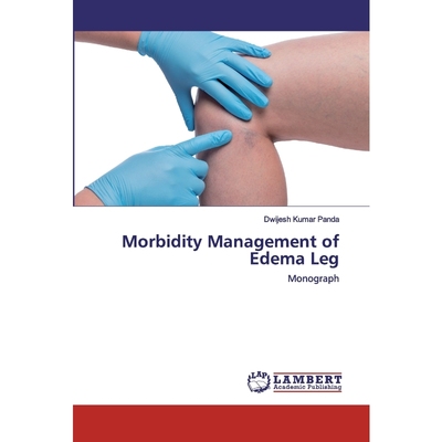 按需印刷Morbidity Management of Edema Leg[9786202563260]