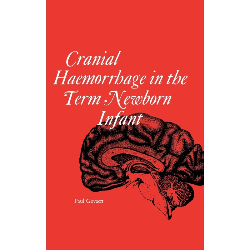按需印刷不退不换Cranial haemorrhage in the term new born infant[9780521451499] - 实物图