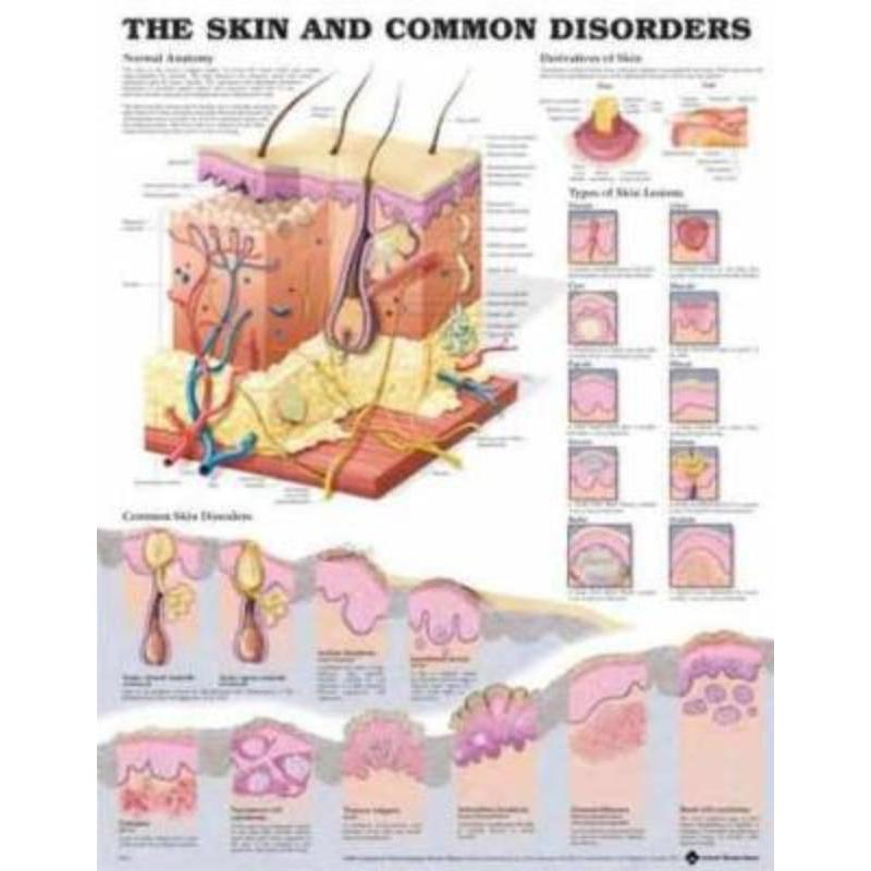 预订The Skin and Common Disorders Anatomical Chart