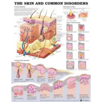 预订The Skin and Common Disorders Anatomical Chart