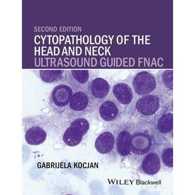 按需印刷Cytopathology of the Head and Neck:Ultrasound Guided FNAC[9781118076026]