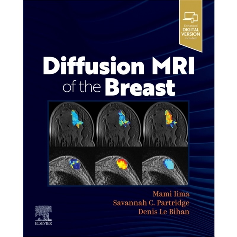 预订Diffusion MRI of the Breast[9780323797023]