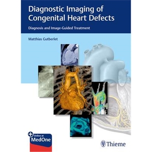 Diagnosis Treatment Guided Image and Defects Heart Congenital Imaging 预订Diagnostic