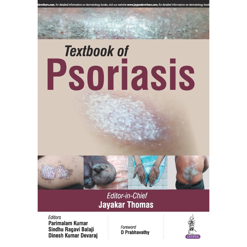 按需印刷不退不换Textbook of Psoriasis[9789352501656]