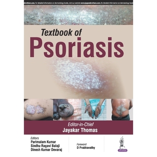 按需印刷Textbook of Psoriasis[9789352501656]