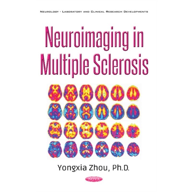预订不退不换Neuroimaging in Multiple Sclerosis[9781536119480]