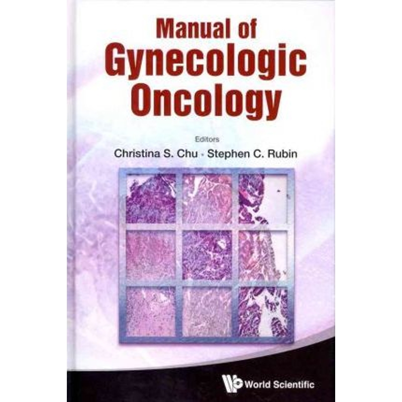 按需印刷Manual of Gynecologic Oncology[9789814343695]