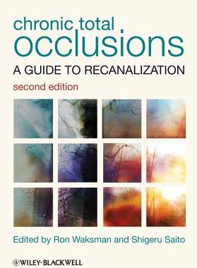 Chronic Total Occlusions: A Guide to Recanalization