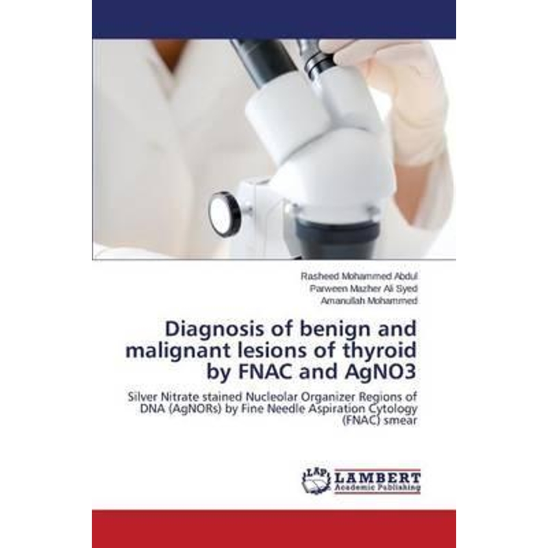 按需印刷Diagnosis of benign and malignant lesions of thyroid by FNAC and AgNO3[9783659717147]