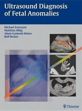 预订Ultrasound Diagnosis of Fetal Anomalies