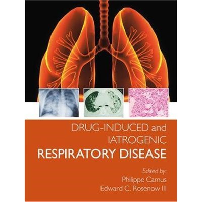 预订Drug-induced and Iatrogenic Respiratory Disease
