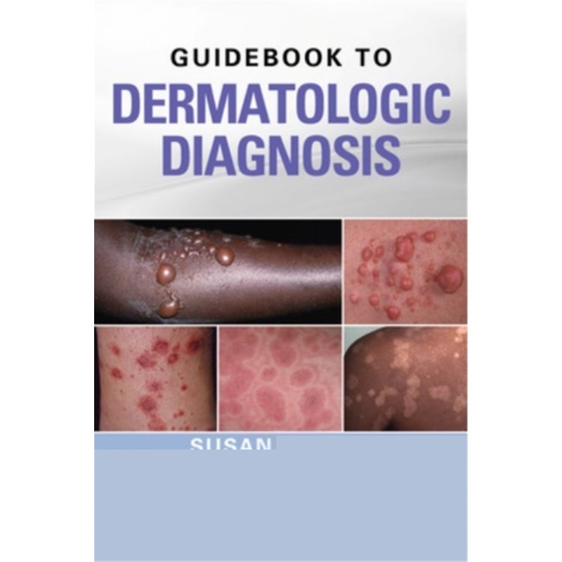 预订Guidebook to Dermatologic Diagnosis[9780071738750]