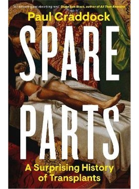 预订Spare Parts:A Surprising History of Transplants