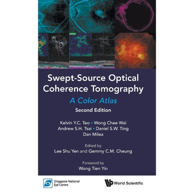 按需印刷不退不换Swept-Source Optical Coherence Tomography[9789813271777]