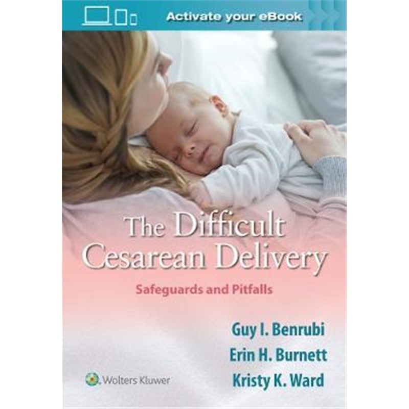 预订The Difficult Cesarean Delivery: Safeguards and Pitfalls