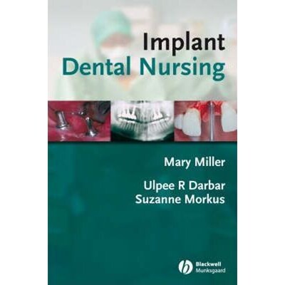 预订Implant Dental Nursing