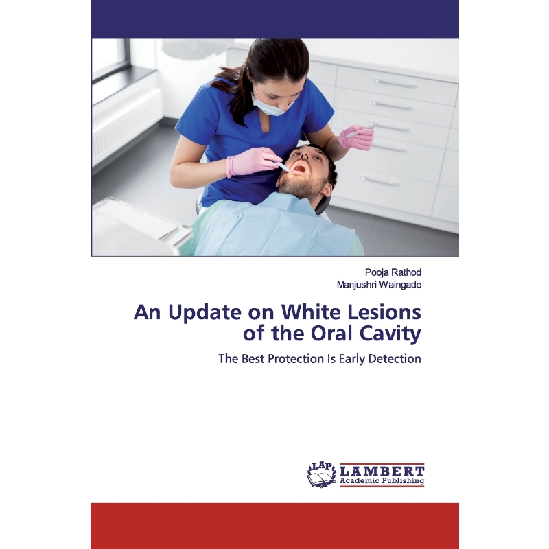 按需印刷An Update on White Lesions of the Oral Cavity[9786200431189]