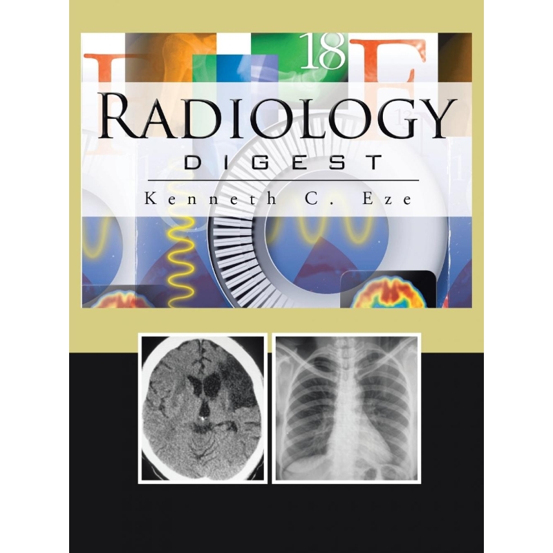 预订，预计下单后2-3周左右发货！