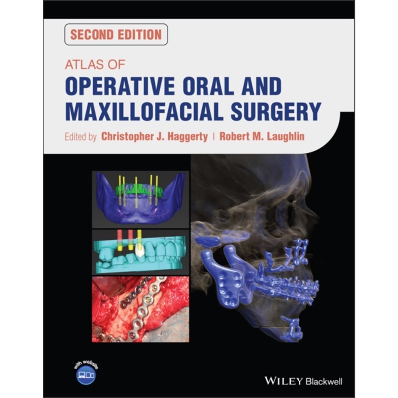 预订Atlas of Operative Oral and Maxillofacial Surg