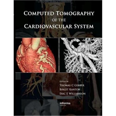 预订不退不换Computed Tomography of the Cardiovascular System[9781841846255]