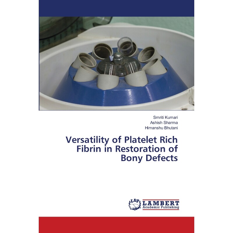 预订，预计下单后2-3周左右发货！