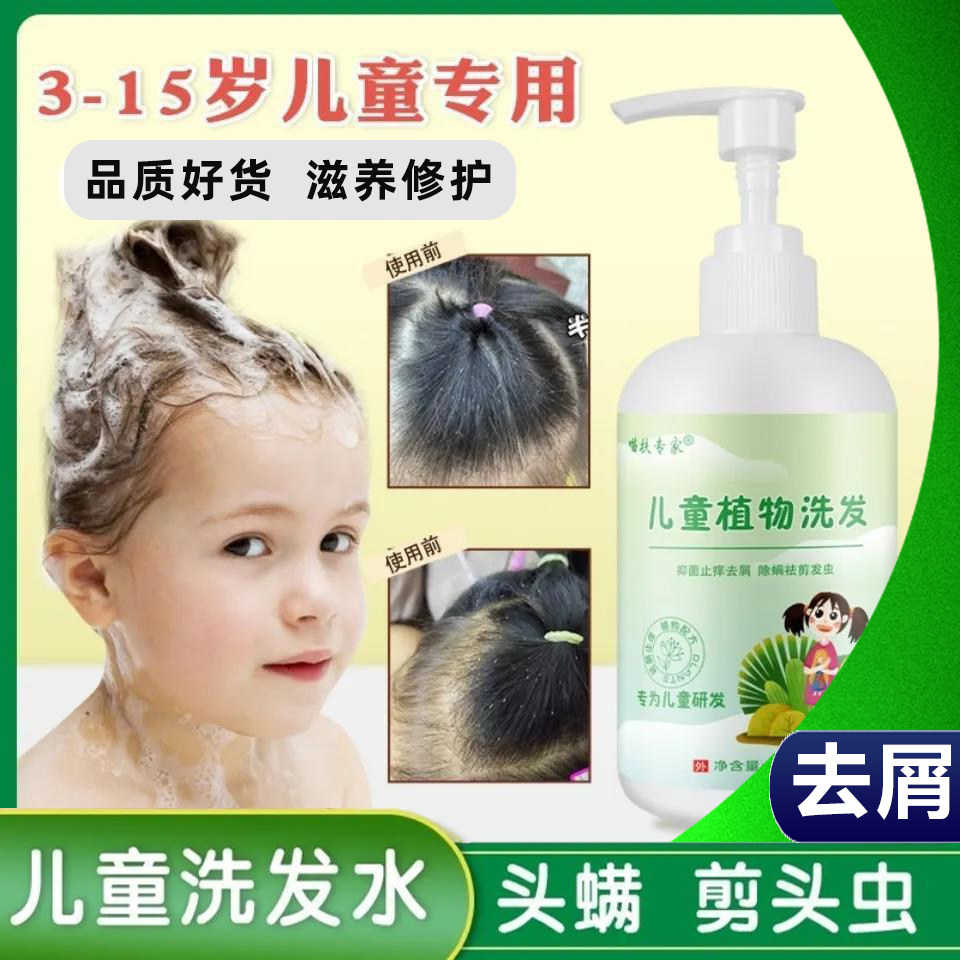 剪发虫儿童除螨虱子头屑舒缓止痒