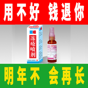 冻疮膏止痒冻伤膏儿童正品防冻宝宝消肿日本手部护手霜神器脸耳朵