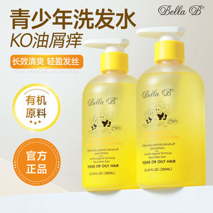 青少年洗发水儿童洗发露控油蓬松去屑止痒专用3-12岁男女童洗头膏