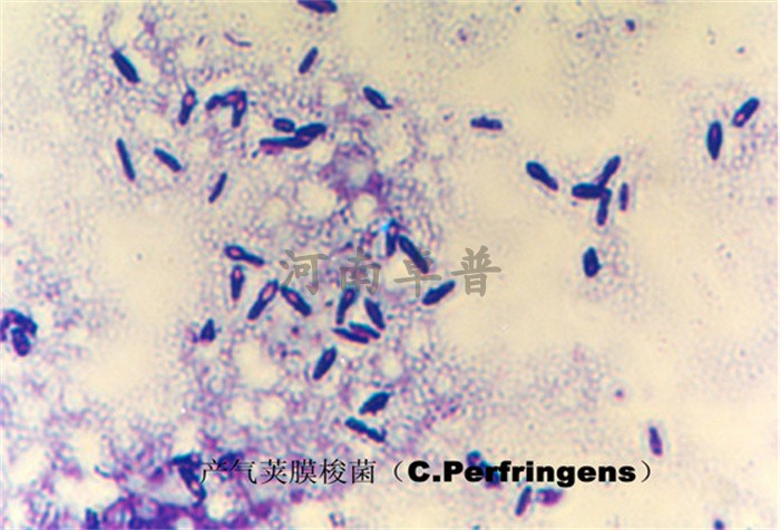 高等院校病理组织学类 肺炎双球菌涂片(荚膜) 生物玻片教学使用