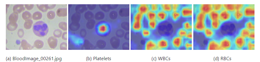 DL00354-改进型YOLOv7血细胞检测分类加入Swin transformer