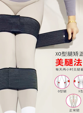 矫正x型o型腿绑腿带小腿外翻直腿