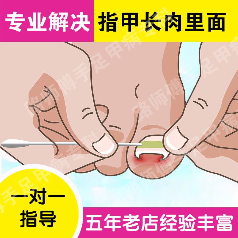 拉拉长肉里神器正甲贴