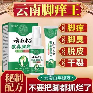 脚上长小水泡痒气专用脚丫上脚底起水泡痒脚上长小水泡型药
