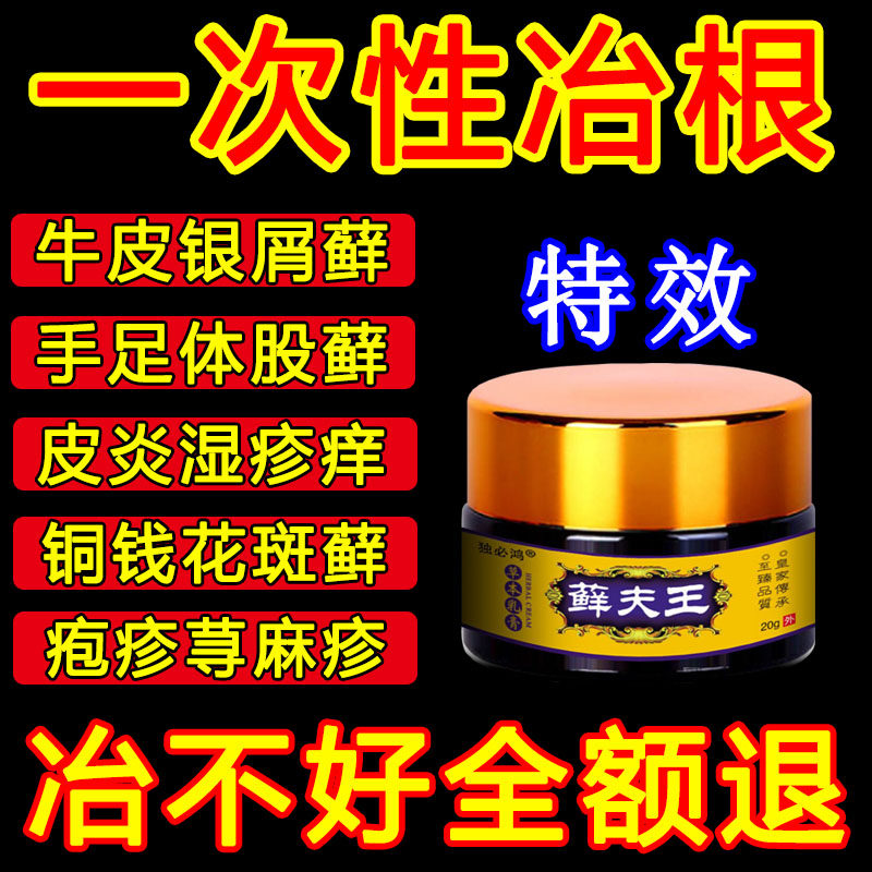 治疗牛皮癬鲜银屑病股藓手足头皮癣水泡湿疹止痒皮肤瘙痒专用药膏