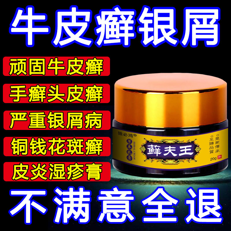 牛皮藓癣鲜银屑病专用手足体股癣头皮肤瘙痒湿疹止痒特效正品药膏