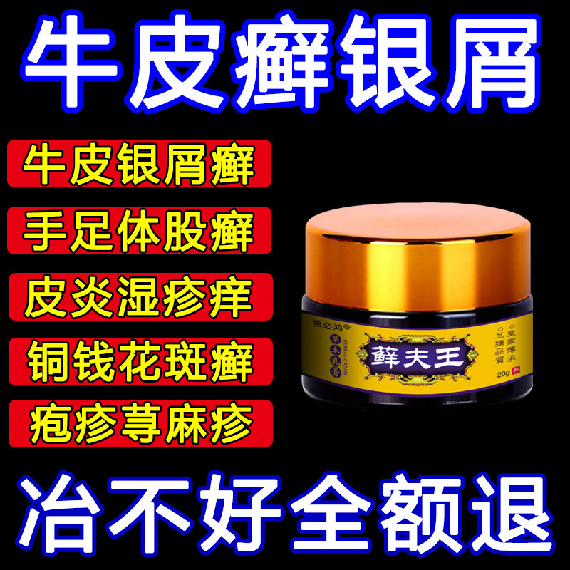 牛皮藓鲜银屑病湿皮肤疹专治疗头皮手足脚体股藓廯外用止痒癣药膏