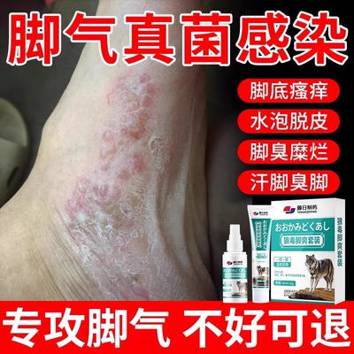 狼毒脚气喷剂喷雾臭烂脚丫脱皮糜烂脚趾缝烂痒脱皮杀菌止痒膏治YH