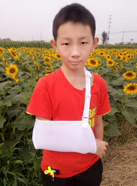 肩关节脱臼胳膊儿童上肢前臂吊带