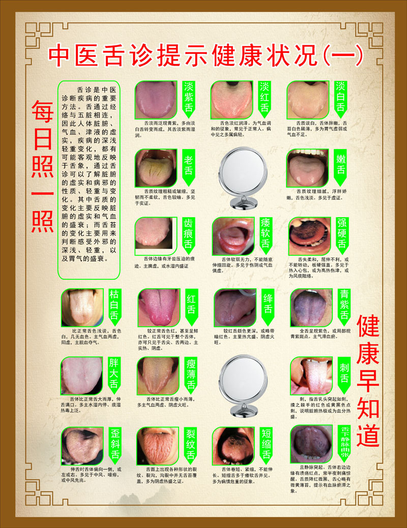 m768中医舌诊提示健康舌头对应症状况1438海报印制展板写真喷绘