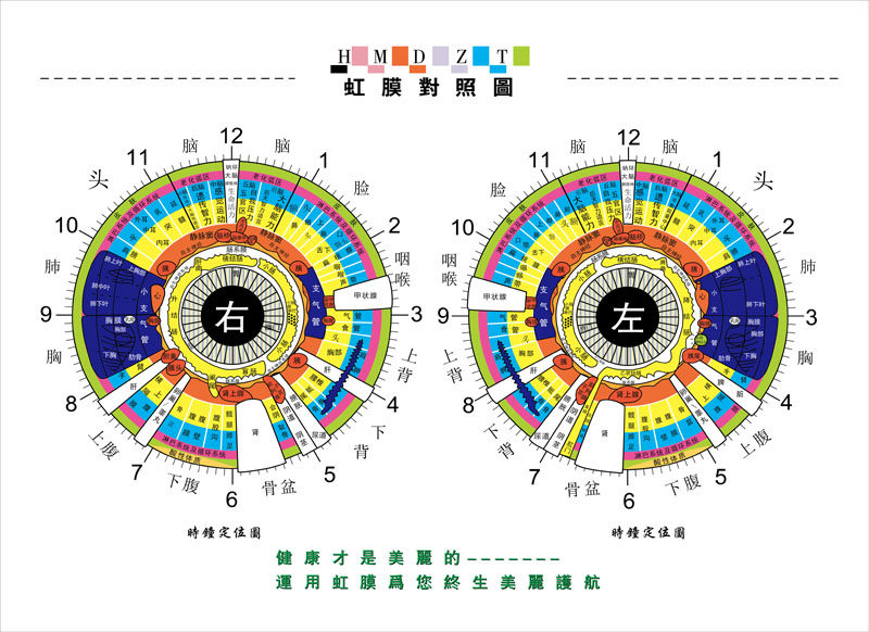 752海报印制展板写真喷绘688医疗知识看眼知健康虹膜检查对照图