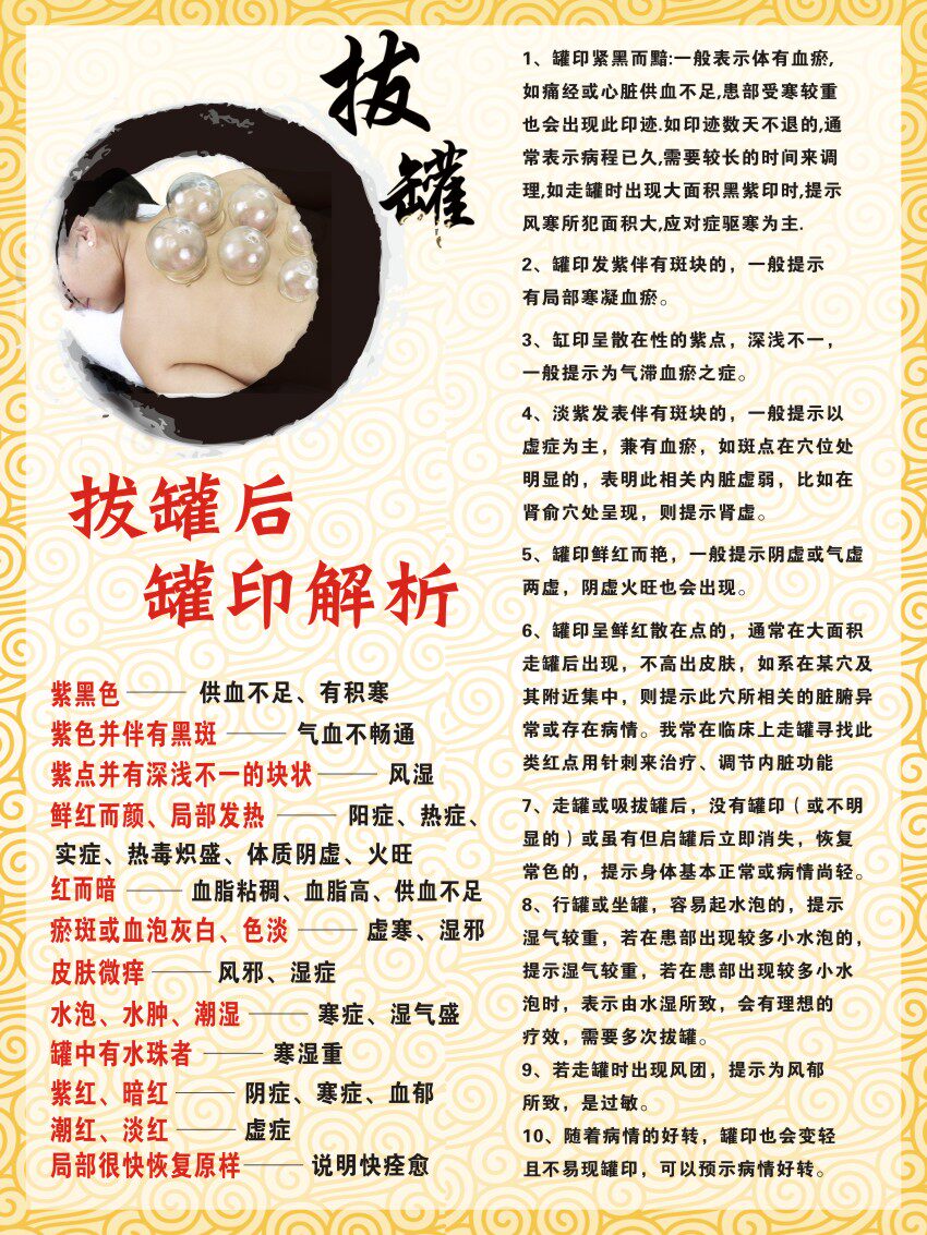 m769中医养生拔罐后罐印解析的对应症状968海报定制展板贴纸喷绘