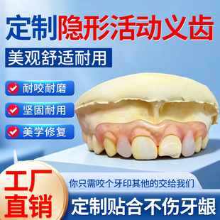 活动隐形义齿假牙定制临时假牙遮丑可拆卸定制活动性义齿牙科同款