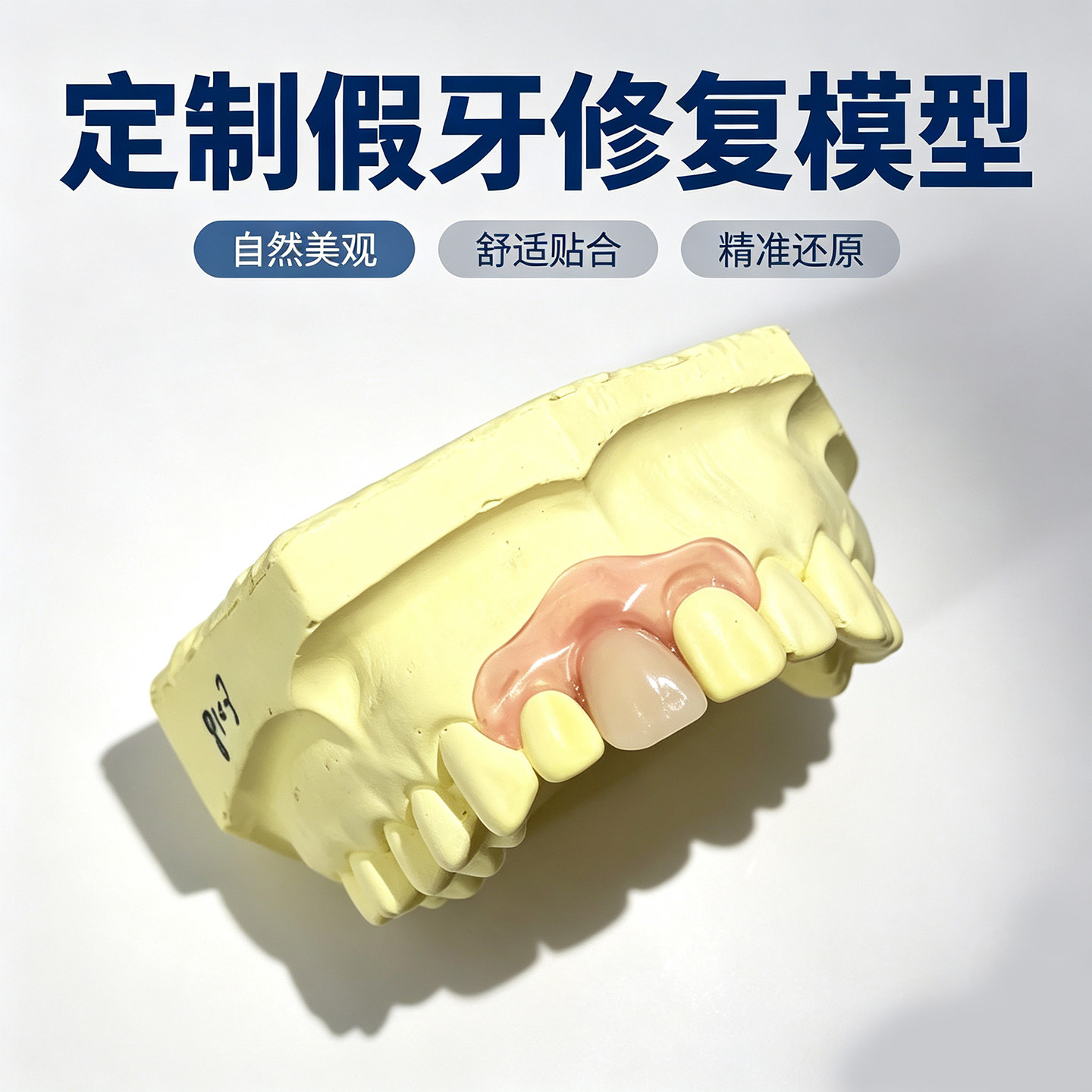 定制式活动隐形义齿假牙齿一颗种植临时冠树脂可摘戴吃饭遮丑缺牙